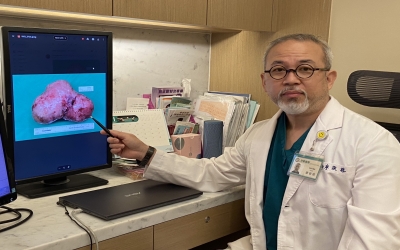 剖腹生產試管寶寶合併摘除15公分帶蒂肌瘤